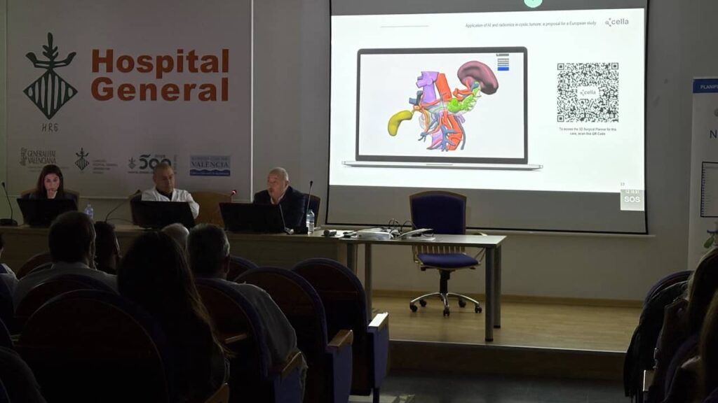 Dr. Luís Sabater Ortí - Modelización 3D de los tumores quísticos pancreáticos - Cella Medical Solutions